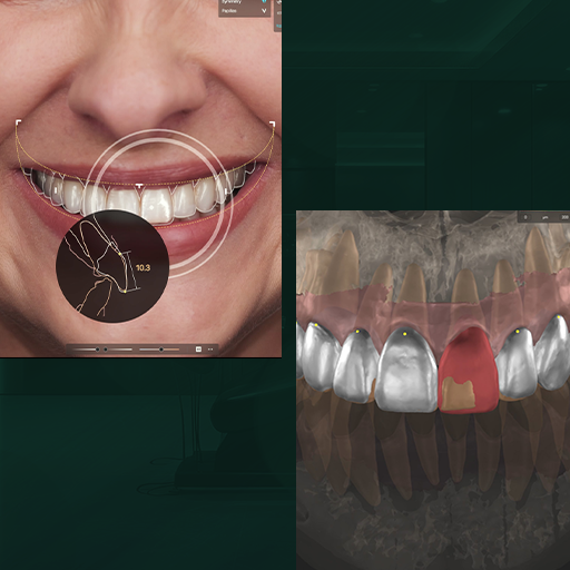 Smile Simulation