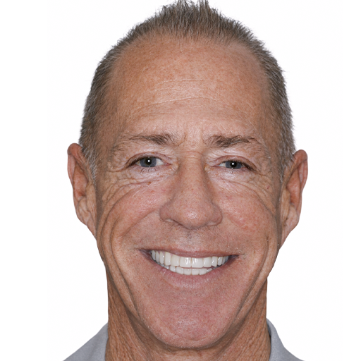 smile makeover after