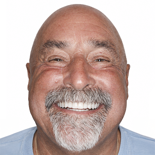 smile makeover after