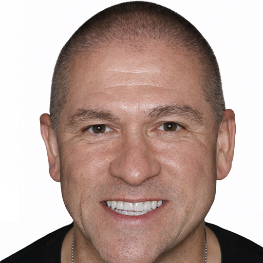 smile makeover after