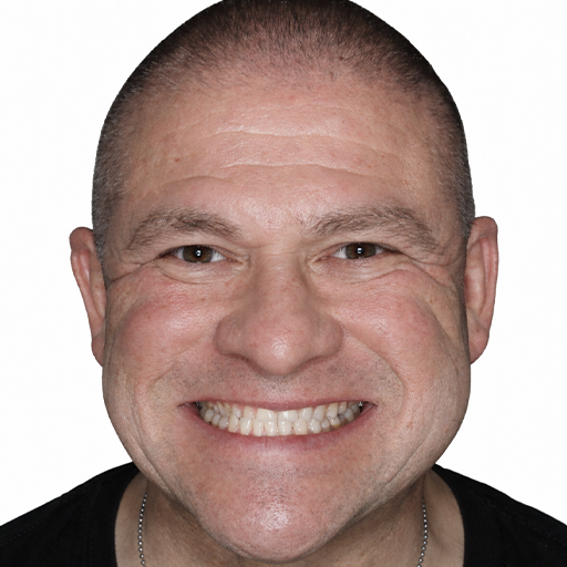 smile makeover before