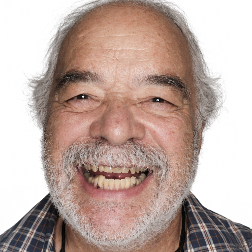 smile makeover before
