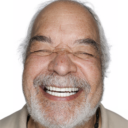 smile makeover after