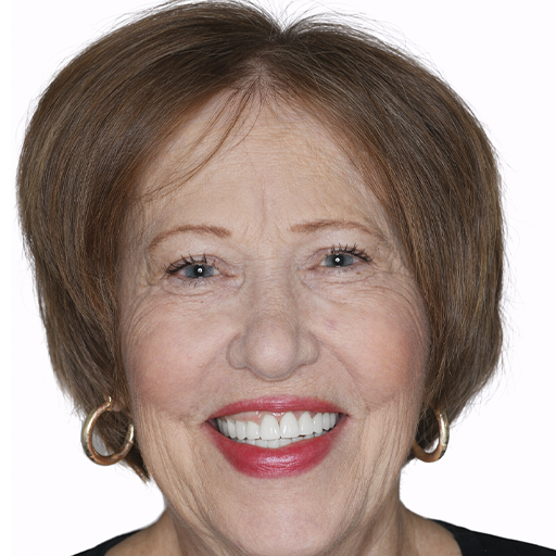smile makeover after