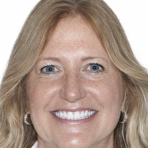 smile makeover after