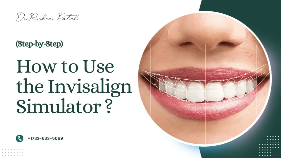 Invisalign Straight Teeth Simulator Invisalign Straight Teeth Simulator