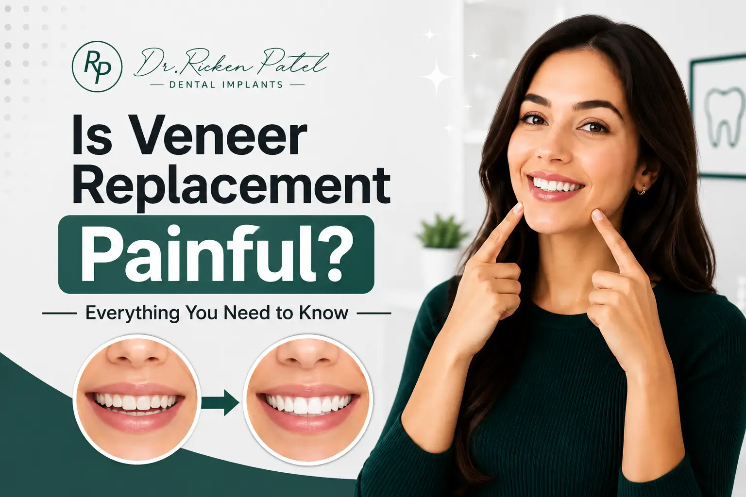 can veneers be removed or replaced